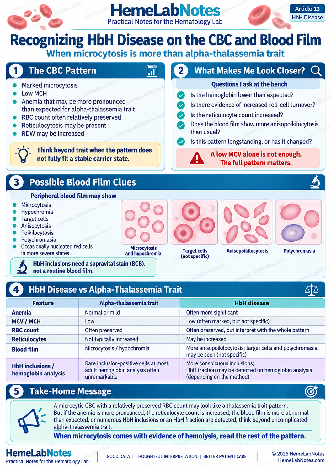 Infographic showing CBC and blood film clues that may suggest HbH disease rather than uncomplicated alpha-thalassemia trait.