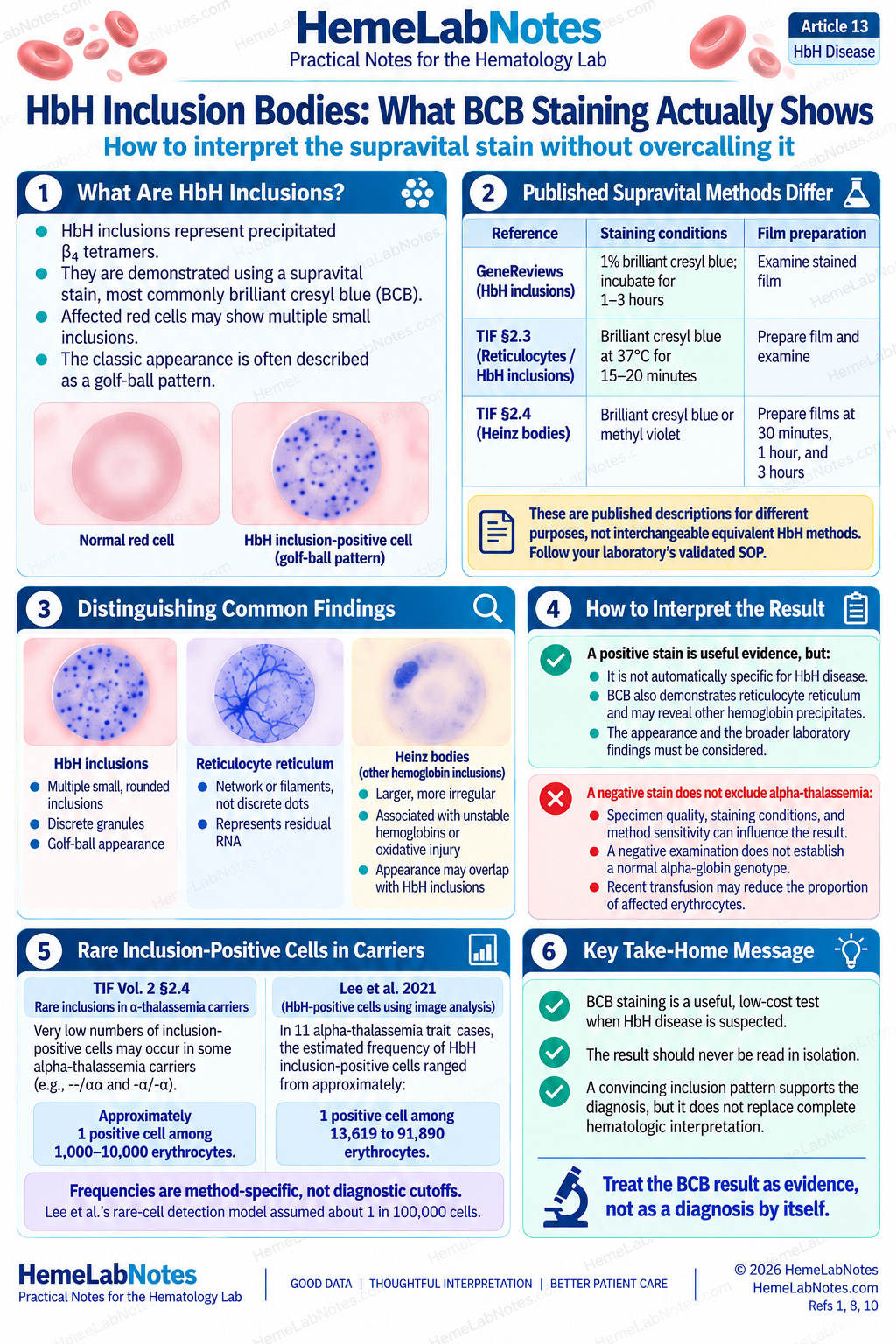 Infographic illustrating HbH inclusion bodies, brilliant cresyl blue staining protocols, microscopic look-alikes, and interpretation limitations.