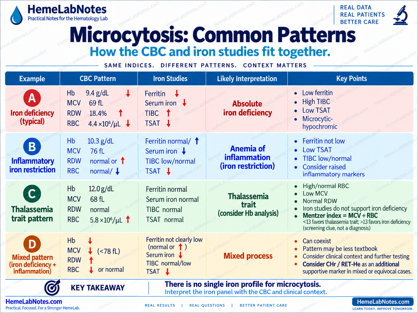 Four microcytosis patterns comparing absolute iron deficiency, inflammatory iron restriction, thalassemia trait, and a mixed iron deficiency plus inflammation pattern.
